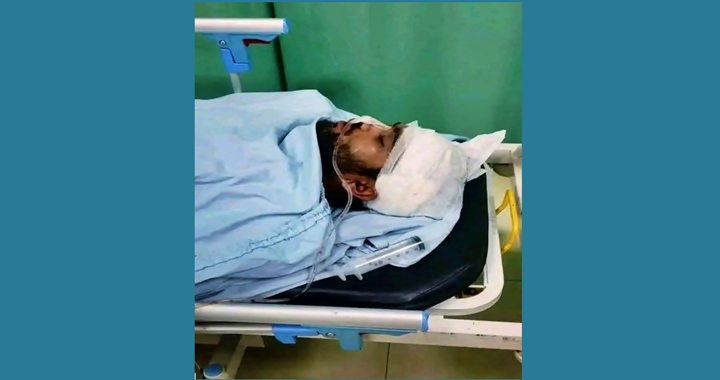 স্থানীয়দের হামলায় আহত চবি শিক্ষার্থী মামুন লাইফ সাপোর্টে