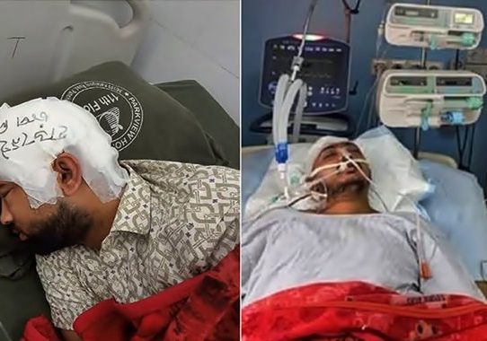 জীবন-মৃত্যুর সন্ধিক্ষণে চবির দুই শিক্ষার্থী