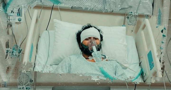 সিটিস্ক্যানে হাদির মস্তিষ্কের ‘ইসকেমিয়া’ বেড়েছে