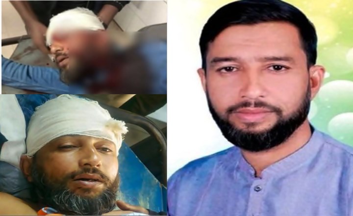 খুলনায় এনসিপির শ্রমিক সংগঠনের নেতাকে মাথায় গুলি