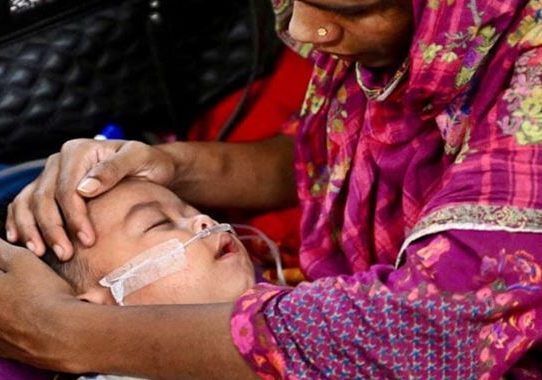 হাম ও উপসর্গ নিয়ে আরও ৭ শিশুর মৃত্যু