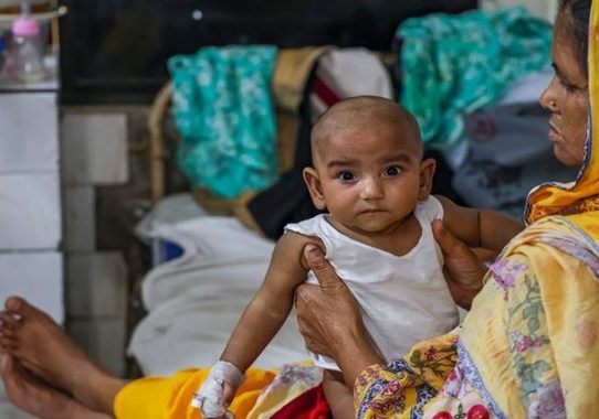 হাম ও উপসর্গ নিয়ে আরও ৮ শিশুর মৃত্যু