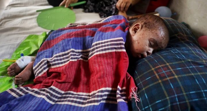 হাম ও উপসর্গ নিয়ে চব্বিশ ঘণ্টায় ১২ জনের মৃত্যু