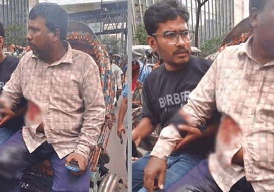 মতিঝিলে ব্যবসায়ীকে গুলি করে ১৭ লাখ টাকা ছিনতাই