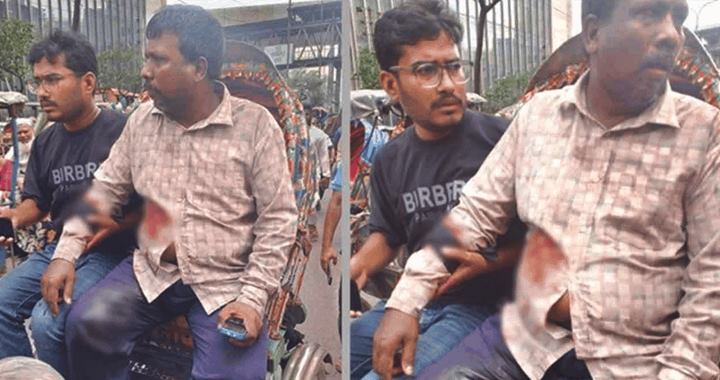 মতিঝিলে ব্যবসায়ীকে গুলি করে ১৭ লাখ টাকা ছিনতাই