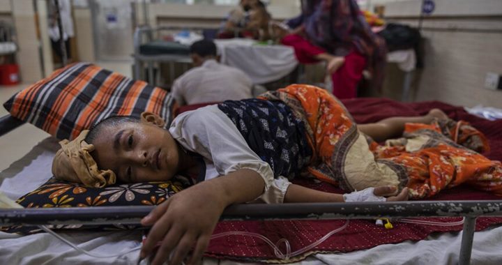 হাম ও উপসর্গে মৃত্যু বেড়ে দাঁড়াল ৬৪৩ জনে